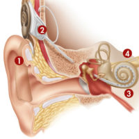 Benign Paroxysmal Positional Vertigo